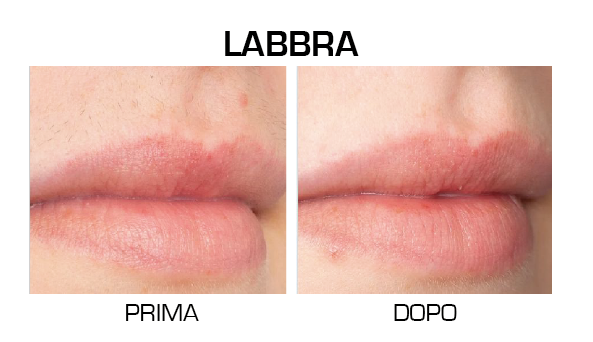 labbra